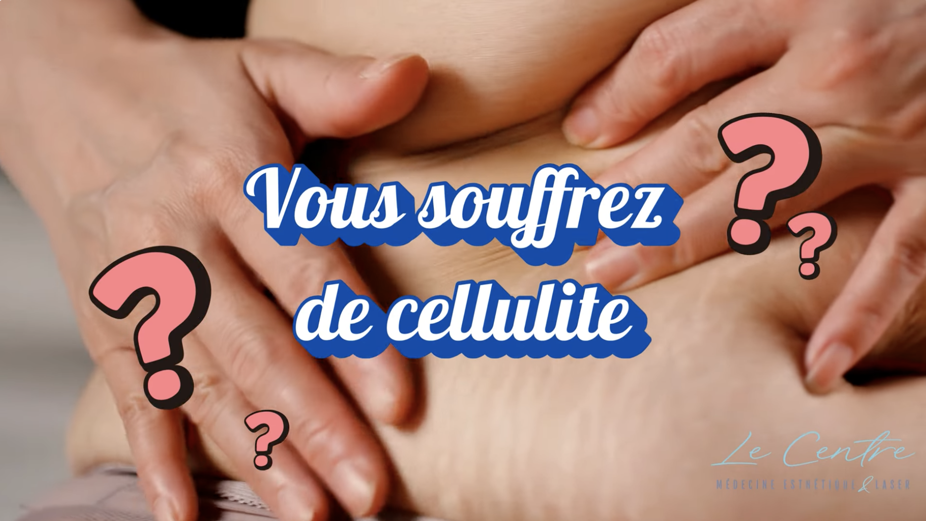 Vous souffrez de cellulite
