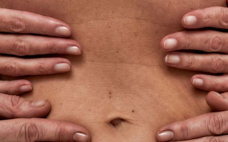 Radiofréquence Legacy