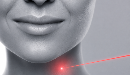 إزالة الشعر بالليزر من الرقبة