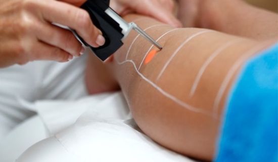 Epilation Laser des cuisses