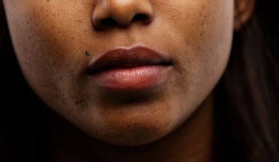 Epilation electrique