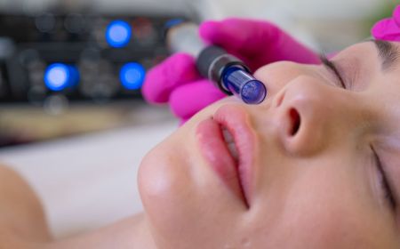 Microneedling