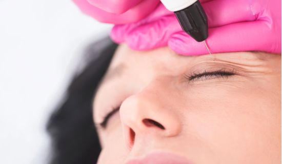 quelle est la difference entre le plexr et la chirurgie blepharoplastie