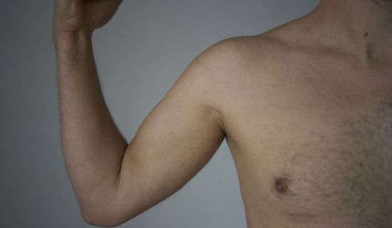 Epilation bras homme