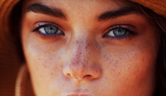 how to eradicate sun spots