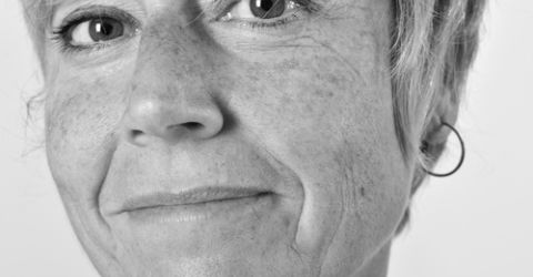 Лазерное удаление пигментации на лице