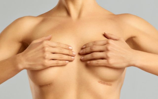 Prothèse mammaire : comment éliminer les cicatrices ?