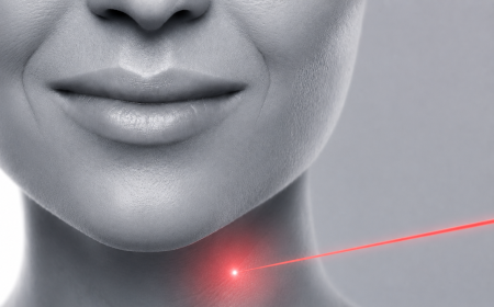 Epilation laser du cou