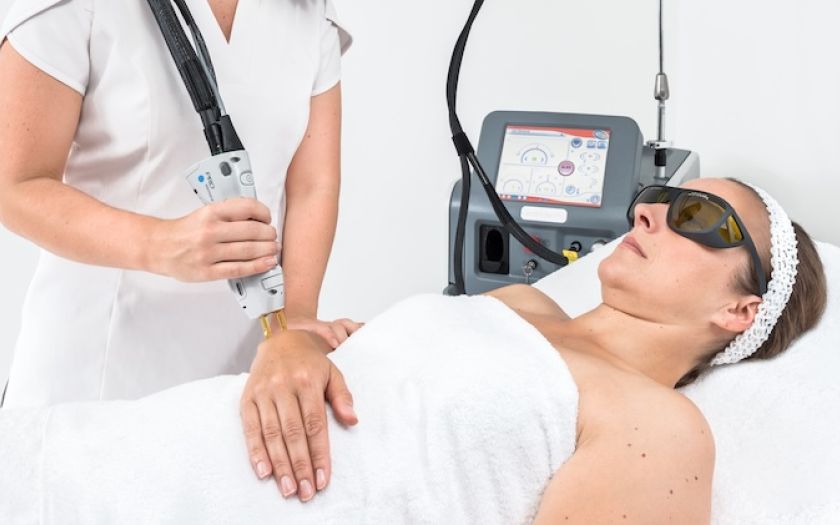 epilation laser des bras