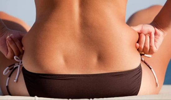 Aesthetic treatment for love handles