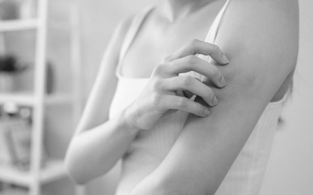 Psoriasis et Eczéma