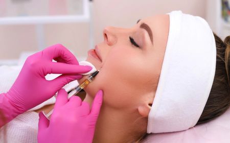 Injections polynucléotides