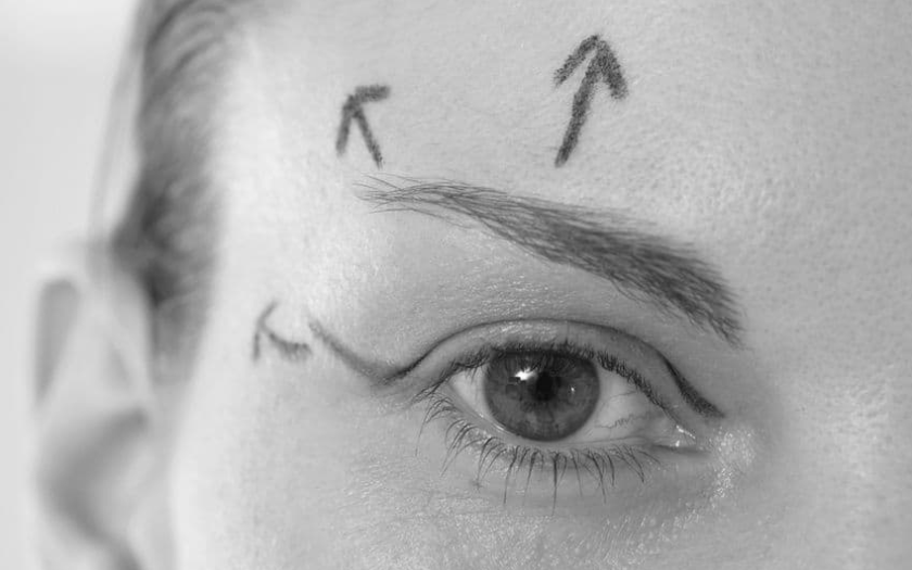 traitement des paupieres