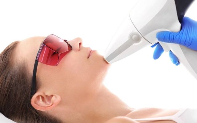 Contrer l’hirsutisme grâce à l’épilation laser