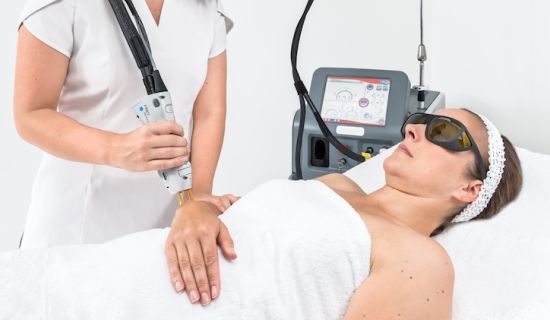 epilation laser des bras