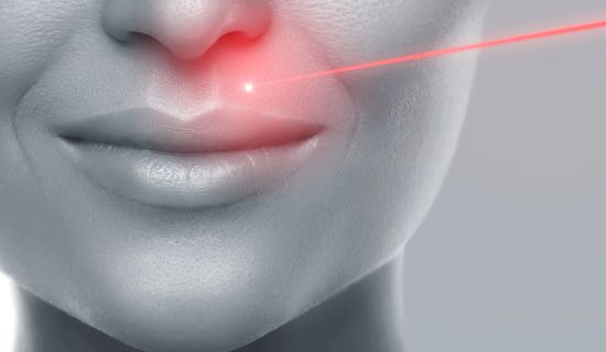 إزالة الشعر بالليزر للشفاه العليا