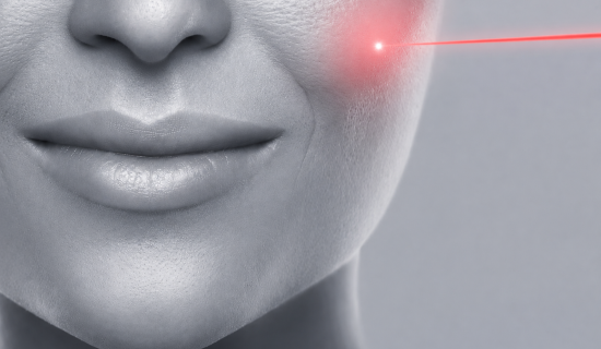 إزالة الشعر بالليزر على المناطق الحساسة