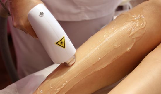 Laser hair removal in Paris