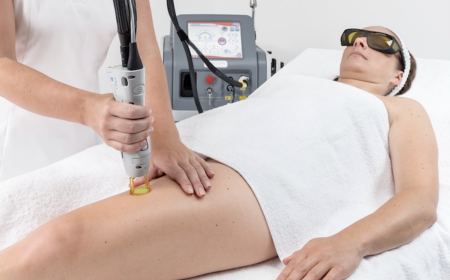 Laser Hair Removal for Women