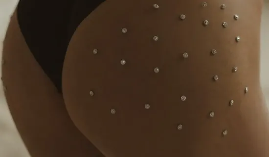 Cellulite aux fesses et aux cuisses