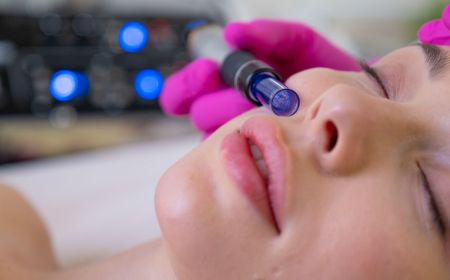 الميكرونيدلينغ